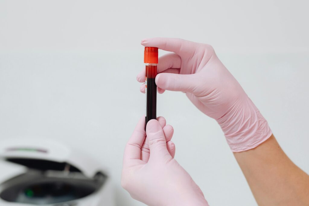 causas de la anemia